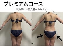 ヨサパーク モアニ(YOSA PARK)の雰囲気（詰めて入ることでまずは見た目に変化が出ます★）
