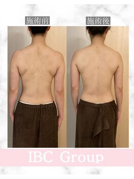 トータルサロンアイビーシー(トータルサロンIBC)/★Before→After