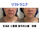 エスポワール(espoir)の写真
