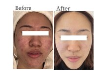 ジェニックサロン グランドギンザ ひたちなか(GENIC SALON GRAND GINZA)/ 日本一の肌改善サロンの実力