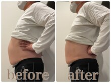 ファビー(Fabby)/マグフォース1回のビフォアフ