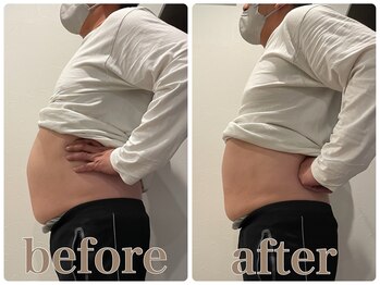 ファビー(Fabby)/マグフォース1回のビフォアフ