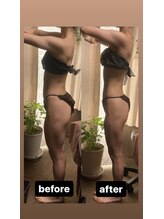 アヌヘア(Anuhea)/インディバ筋膜リリース