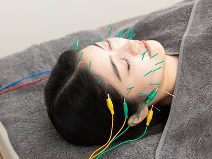 オプト(opt.)の写真