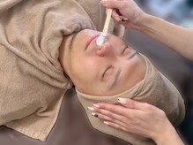 エピナ 横浜店(Epina)/髭MIX脱毛でジョリジョリ解放☆