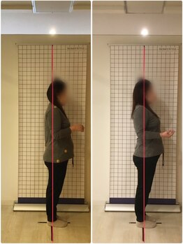 越谷KAJI整体院/腰痛、肩こり