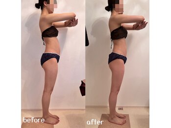 ベレミアム(Bellemium)/骨格調整&痩身リンパ