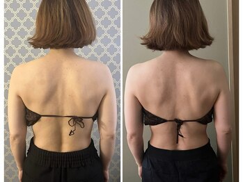 マイティー整骨院 ココア(CoCoa)/肩甲骨洗浄