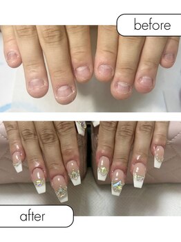 ピノ(pino)/◆深爪矯正＋長さだしアート◆