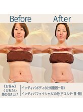 スー(Sue)/体&顔両方お手入れできます