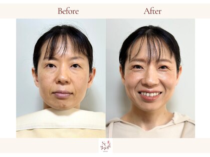 スタイルキューピット(style cupit)の写真