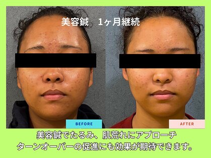 晴々の写真