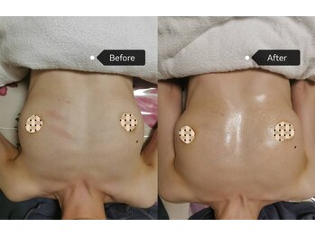 シークレット(Secret)の写真/授乳後の萎みも加齢美しいバストへ整える！ボディラインを整えたい貴方の味方♪