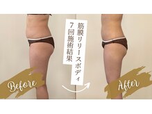 ルー(Lu)/ビフォー＆アフター