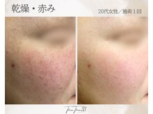 スリースリー(THREE THREE)/乾燥・赤みケア