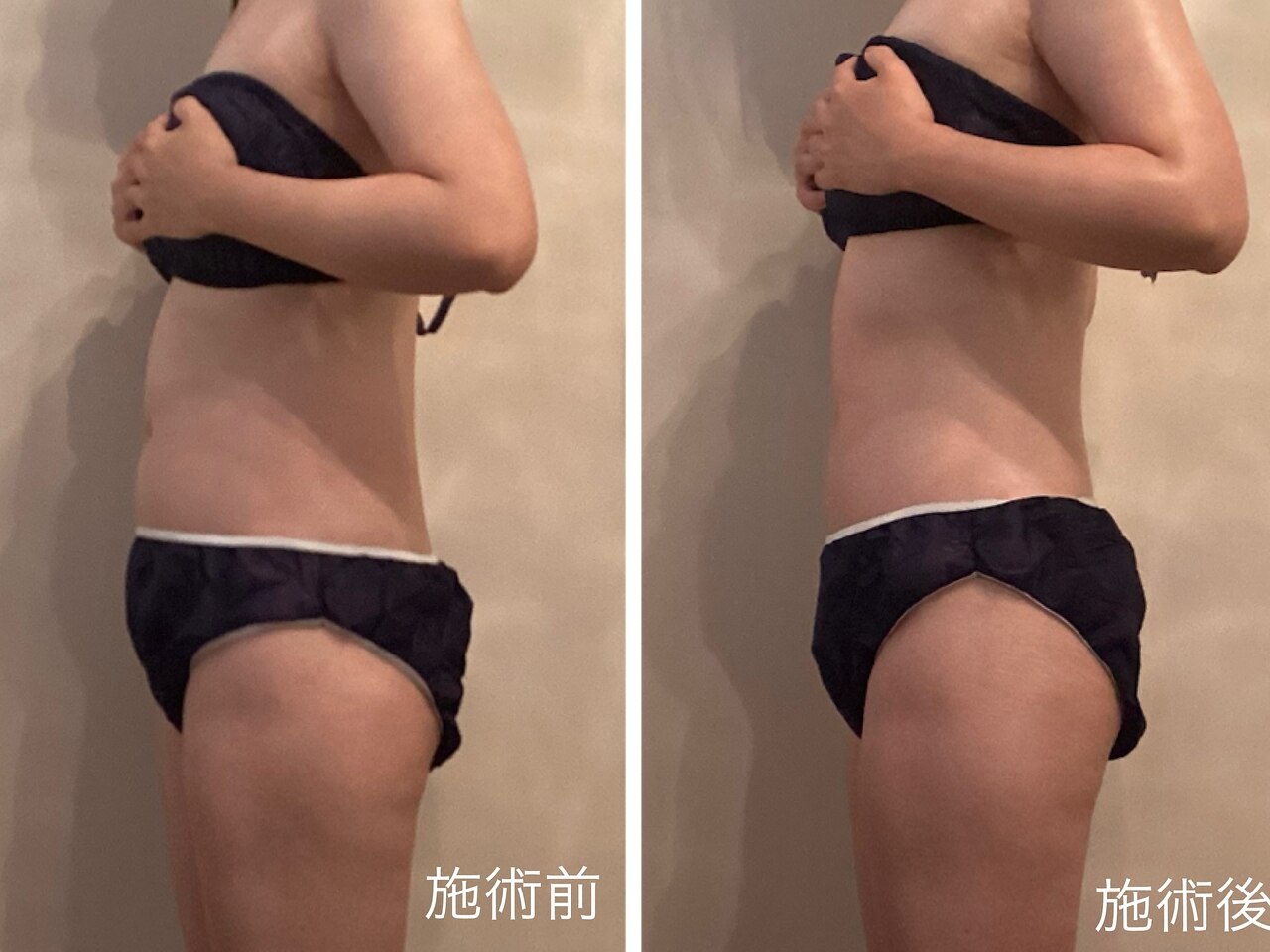 テテラ(tetela)｜ホットペッパービューティー