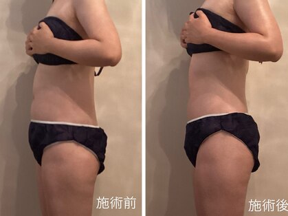 テテラ(tetela)の写真