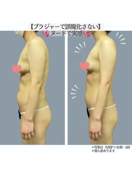 サムサラ(SamSara)の写真/【痩身×ふっくらバスト】背中や脇肉のお肉がバストに集まれば・・・と誰もが思ったことあるはず！