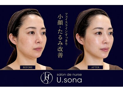 サロン ド ナース ユー ソナ(salon de nurse U.sona)の写真