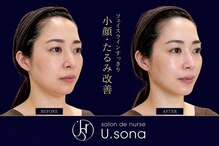 サロン ド ナース ユー ソナ(salon de nurse U.sona)