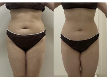 モゼ(moze)/プライムセラム