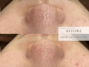 レヴィア(Revia)/毛穴ディープクレンジング