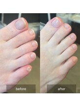 アイル(isle)/【爪をキレイにしたい】お客様