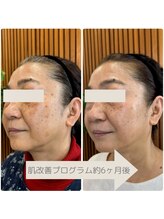 ユーブルーム(youbloom)/お肌を土台から強くする