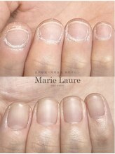 マリーロール 天王寺店(Marie Laure)/自爪育成/深爪矯正/ネイルケア