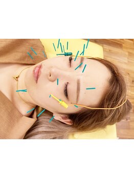 鍼灸施術を受けたい