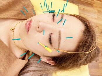 あおなみ はり きゅう整骨院 三浦海岸院の写真/【美顔鍼】肌トラブルは美顔鍼で解決!50本の鍼でマスクを外しても自信の持てる表情へ♪