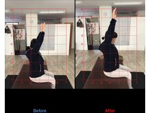 ストレチックス 近江八幡店/BeforeAfter