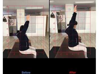 ストレチックス 近江八幡店/BeforeAfter