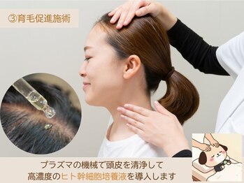 ソワン/ヘッドスパ/育毛促進/頭皮改善