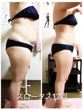 キャルム/スロータスコース