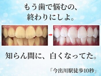 ホワイトニングショップ 今出川店(WHITENING SHOP)