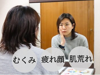中目黒ゆう鍼灸 整骨院/むくみ/疲れ顔/肌荒れ/中目黒