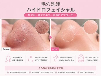 ココ 千里丘(Cocoh)の写真/【毛穴、お肌のケアはCocohへおまかせ♪】黒ずみを改善し、お肌をきれいに！肌質改善で透明感のある美肌に*