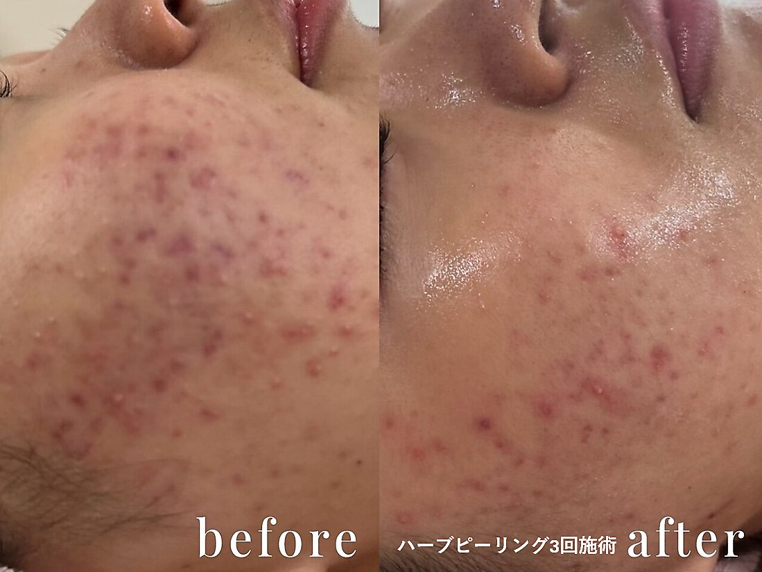 ピュアージュ｜ホットペッパービューティー