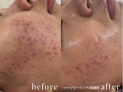 ピュアージュの写真
