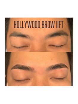 ヴィーナス アイビューティー(VENUS Eye Beauty)/ハリウッドブロウリフト