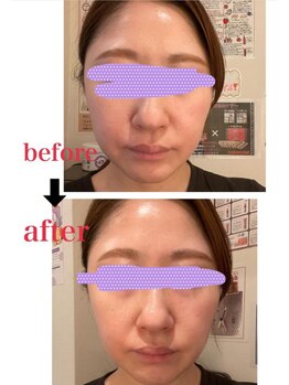 クレビア 神保町 水道橋(CREBIA)/フェイシャル/痩身サロン