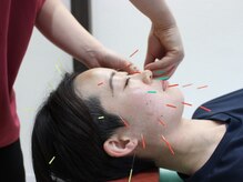 五反田駅前鍼灸整体院