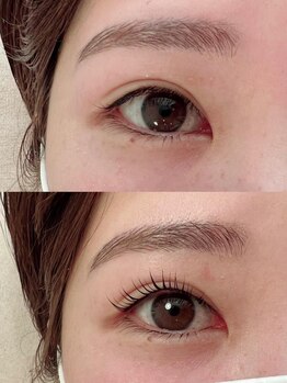 ブルーリボン(blue ribbon)の写真/ネイル（ハンド・フット）＆アイ（まつ毛・眉毛）やリラクメニューも同時施術◎お好きな組み合わせ可！