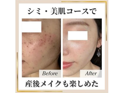 ココ(KOKO)の写真