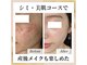 ココ(KOKO)の写真