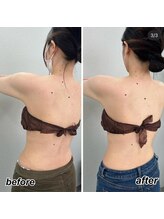 ヴィーナス(Venus)/ブライダル痩身　3回