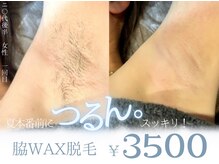 エット(ett)