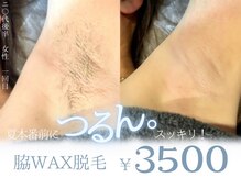 エット(ett)