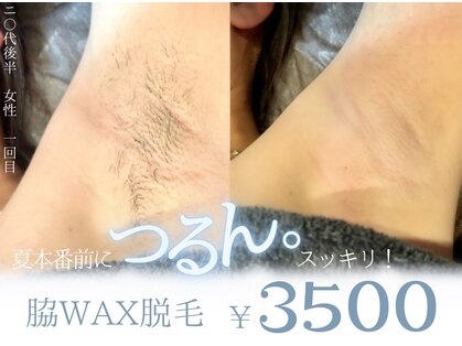 エット(ett)の写真